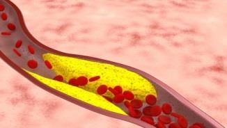 PI_CLT_Neuro-001_คำแนะนำผู้ป่วยโรคหลอดเลือดสมอง(Post stroke )(EN)_Page_1_Image_0003.jpg