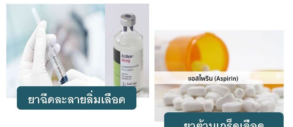 PI_CLT_Neuro-001_คำแนะนำผู้ป่วยโรคหลอดเลือดสมอง(Post stroke )(TH)_Page_07.jpg